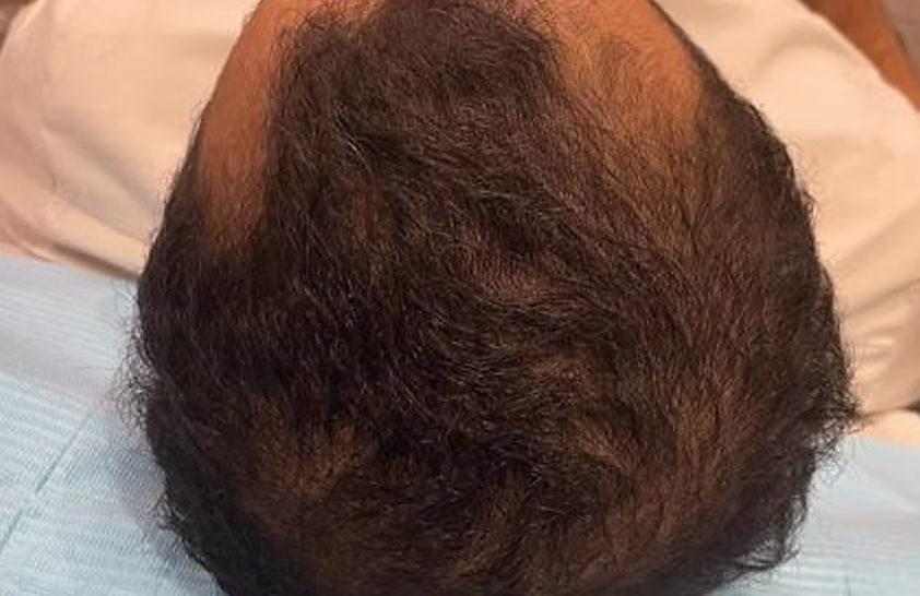قبل العلاج